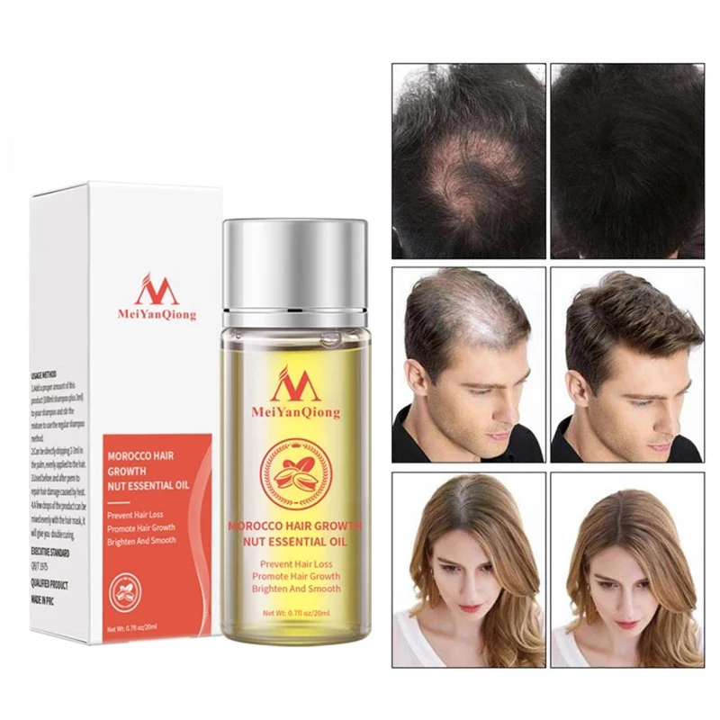 1pcs Nut Hair Growth Oil Fast Hair Growth Oil Nourishes Prevent Hair Loss Thinning Repair Damaged Hair Care Products 20ml