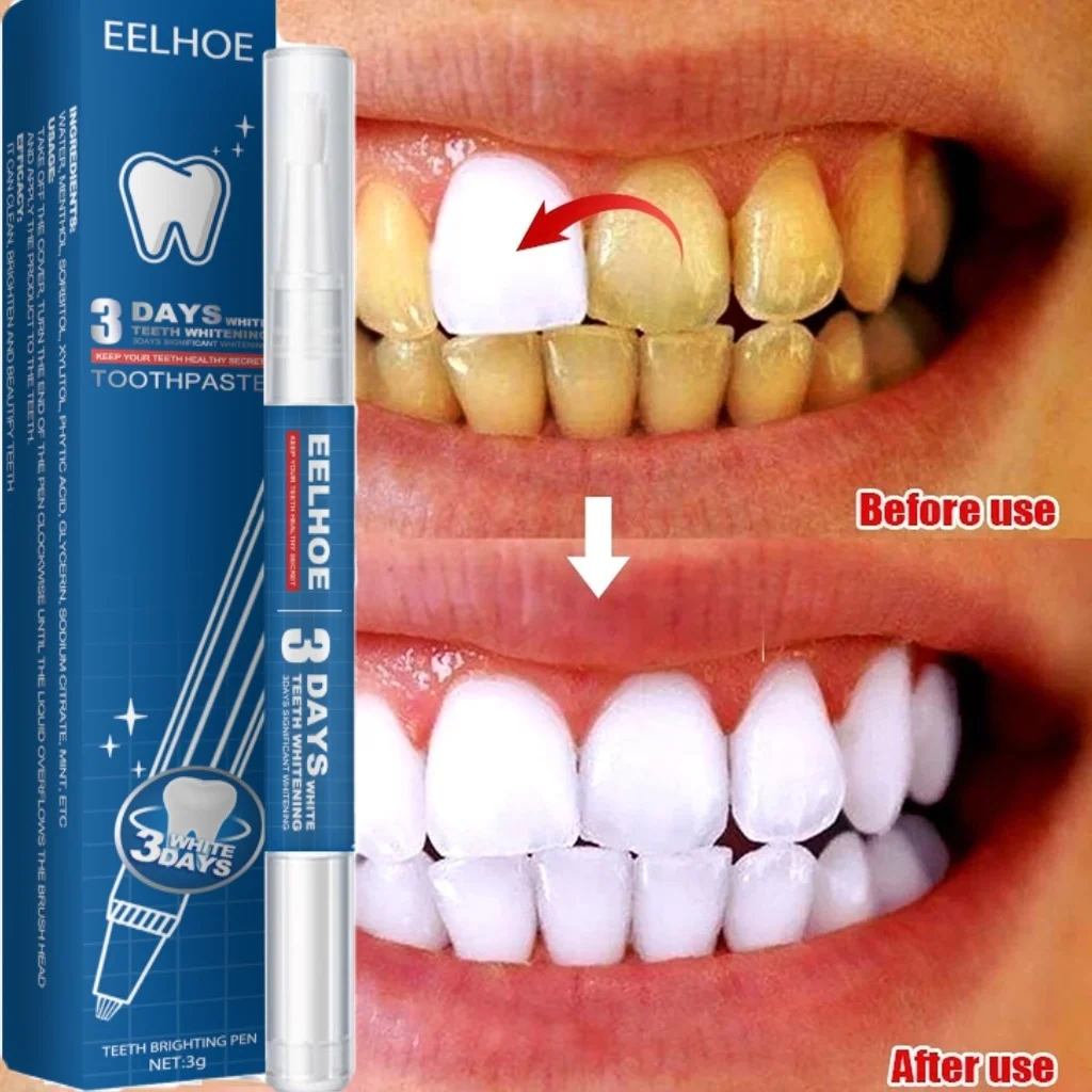 

Teeth Whitening Pen Instant Remove Tea Smok Stain Plaque Deep Cleaning Oral Hygiene Tools Dental Fresh Breath Bleach Teeth Care