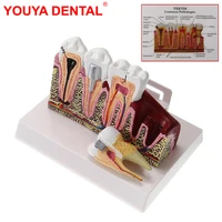 dental anatomical model standard oral teeth model for studying teaching demonstration fully anatomical teeth structure model new