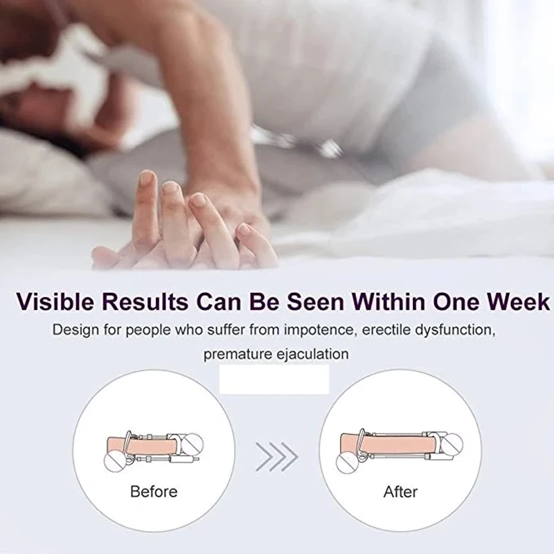 Удлинитель пениса увеличитель мужского t-образные растяжки медицинское