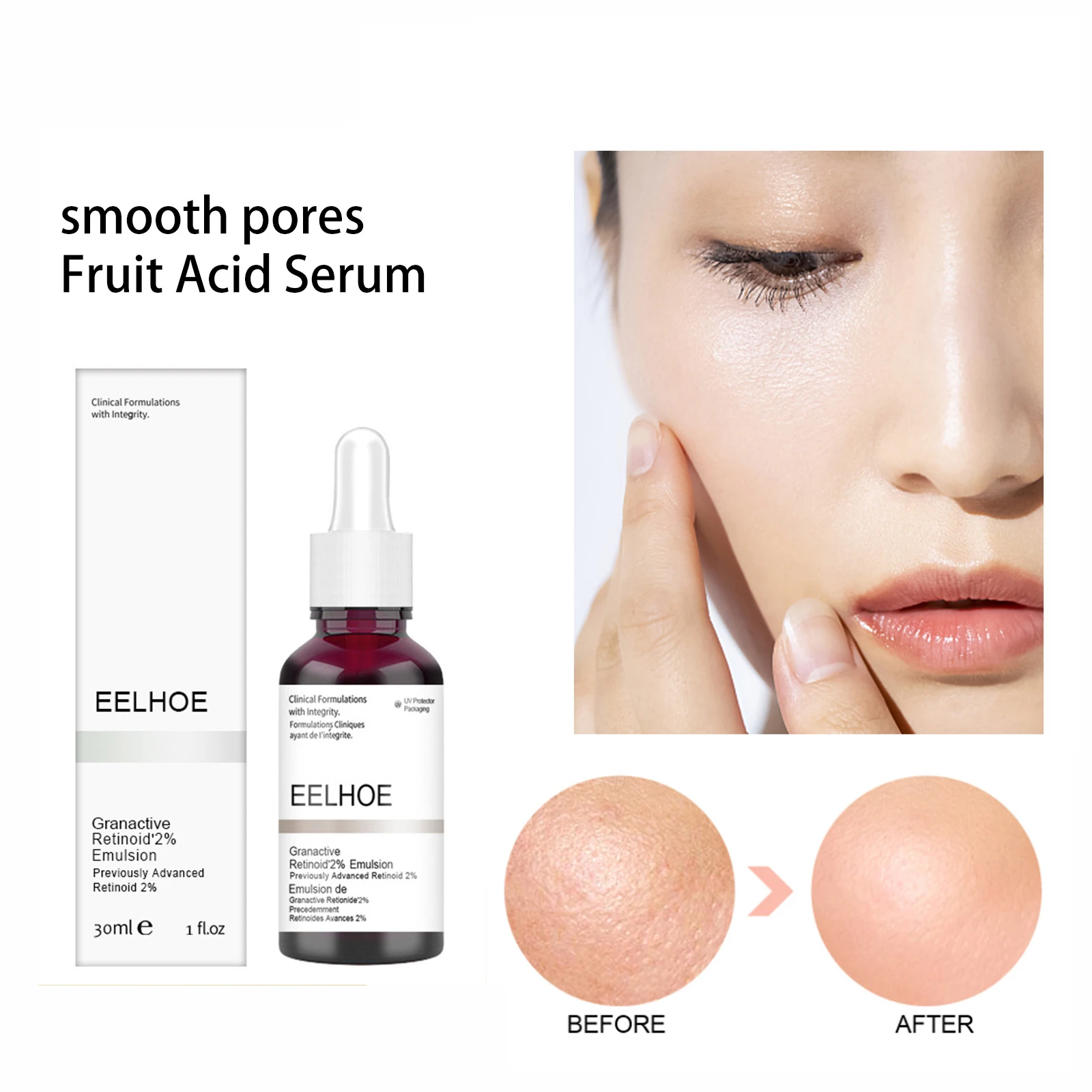 

1pc Salicylic Acid Serum Face Makeup Peeling Solution Acne Pimple Removal Blackhead Improve Shrink Pore Repair Facial Skin Care