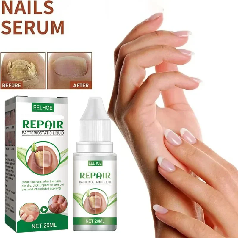 Эфирное масло для ногтей