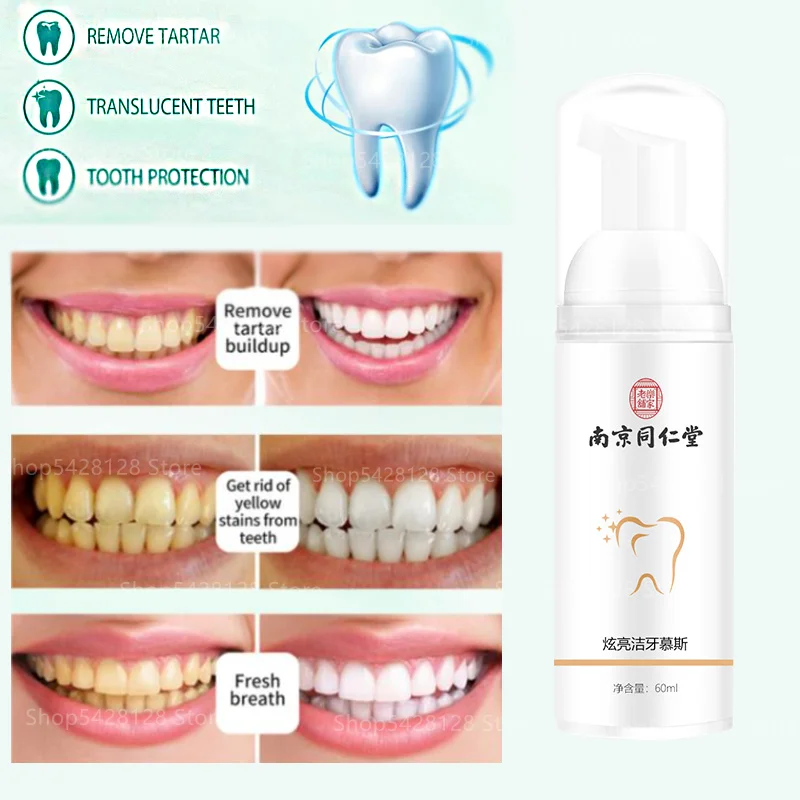 

Teeth Cleaning Mousse Foam Toothpaste Whitening Teeth Remove Yellow Stains Tartar Tartar Gloss Eliminate Bad Breath Fresh Breath