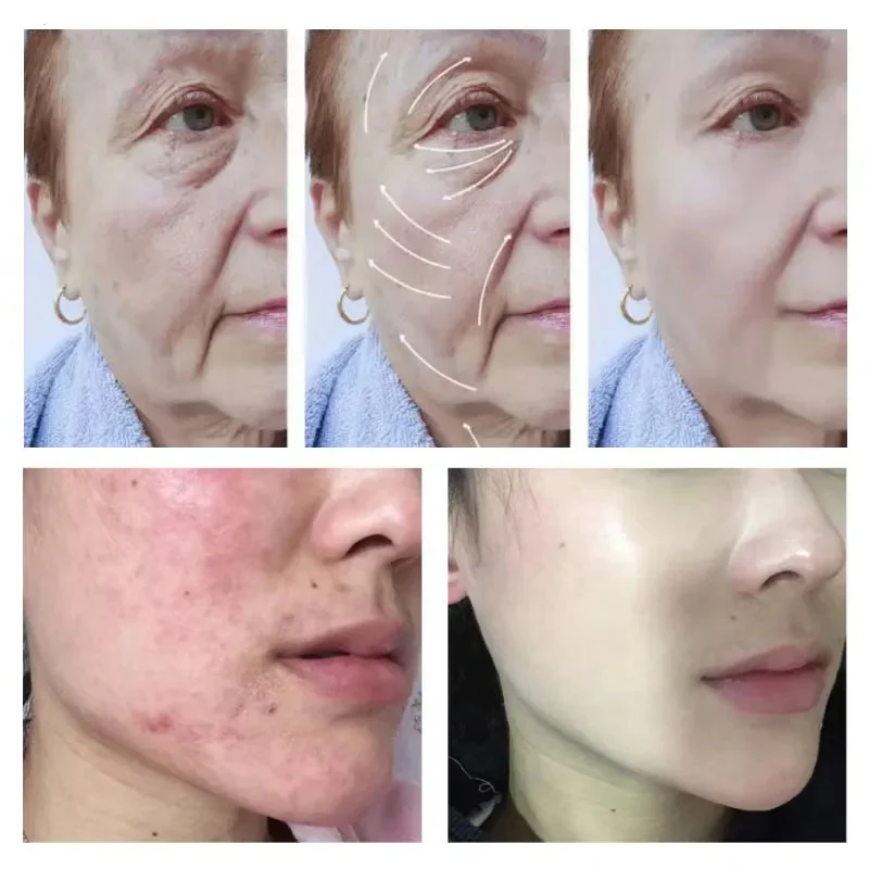 Восстанавливающий и увлажняющий крем для лица с тонкими линиями