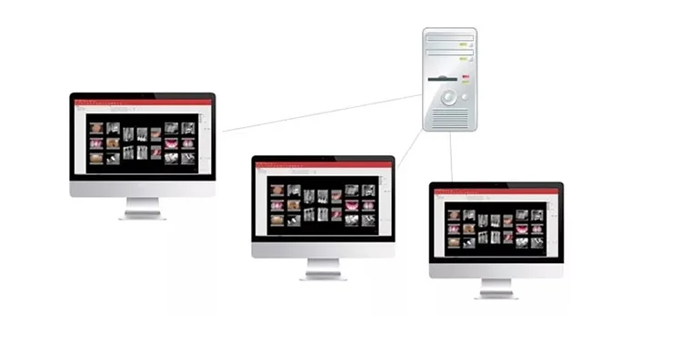 Дешевый стоматологический датчик Цена HDR-500/600B Стоматологический рентгеновский