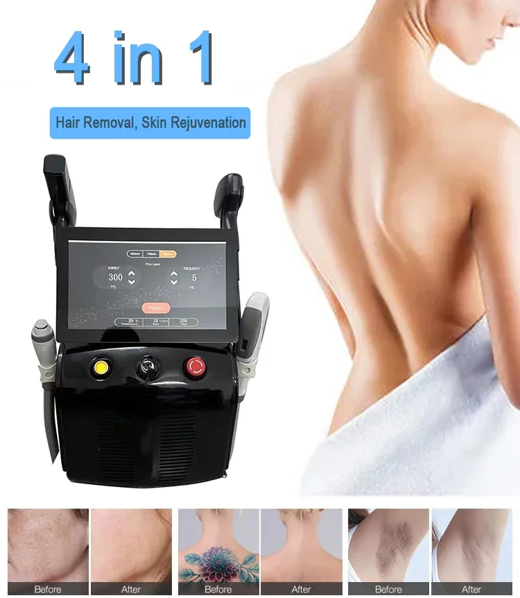 Фото Мультифункциональная машина для удаления волос 4 в 1 OPT IPL Ice Pitanium 808NM Диодная эпиляция Nd Yag Лазерная машина для удаления татуировок №4