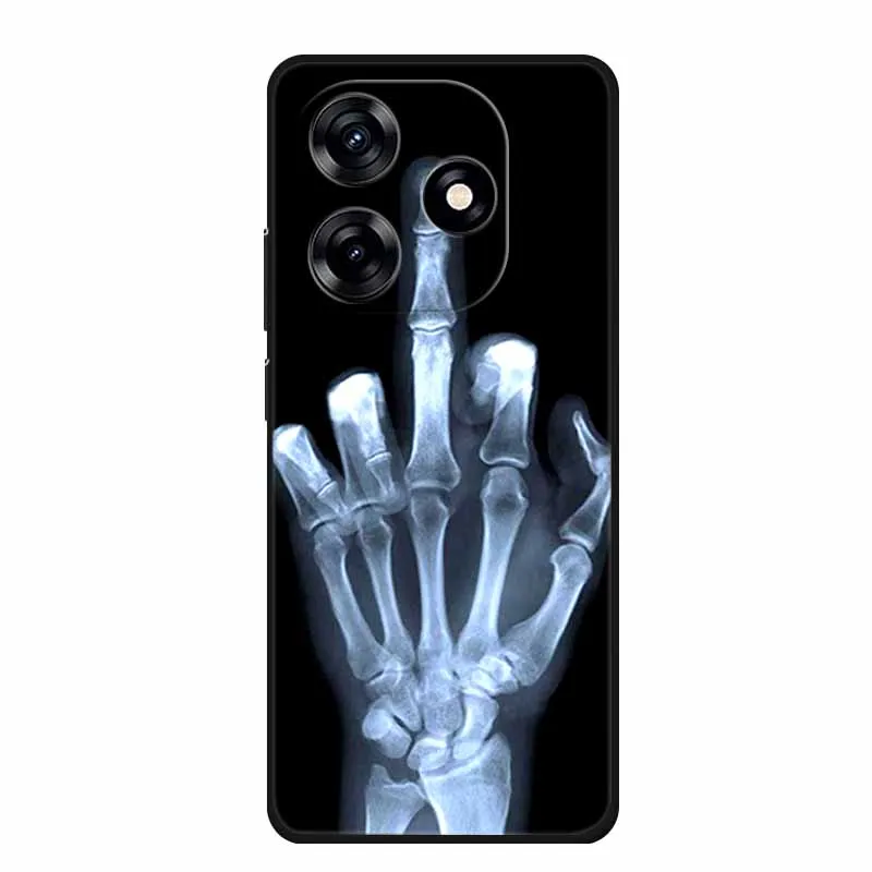 Фото Чехол для Honor Play 10A 2025, модные мягкие черные силиконовые чехлы для телефонов из ТПУ для Honor X5c Plus, задняя крышка, чехол X 5 C Coque Funda №3
