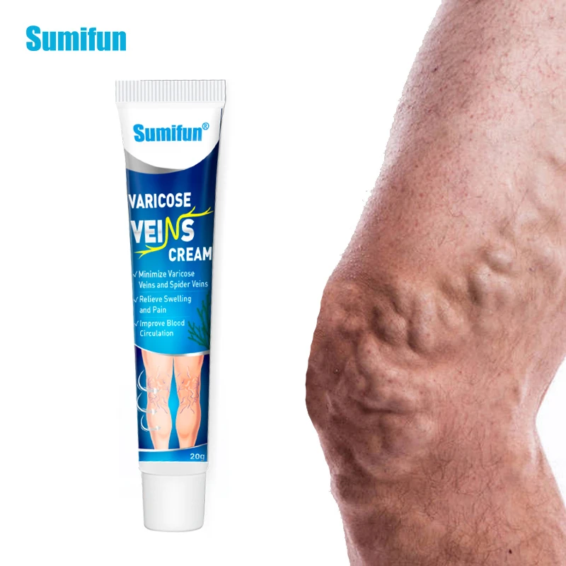 

New Sumifun 1Pcs 20g Varicose Vein Ointment Treatment Vasculitis Blood Vessel Swelling Spider Pain Relief Cream Health Care