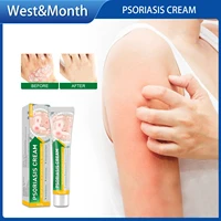 itchy psoriasis cream anti itch cream skin scalp ringworm eczema dermatitis antibacterial treatment care itching ointment 20g