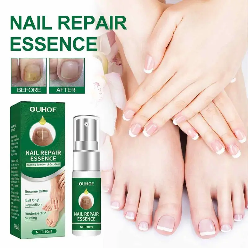 

Nail Repair Essence 10ml Toenail Repair For Curing Nail Repair Essence For Damaged Fingernail Discolored Foot & Toe Medication