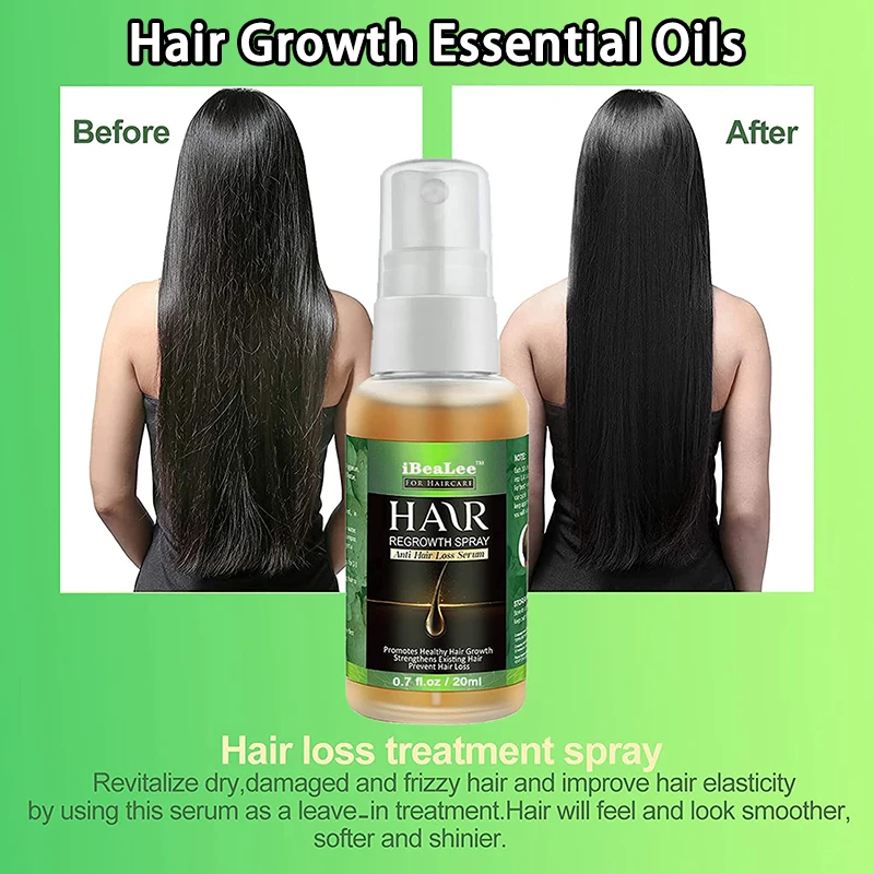 

100% Имбирная Сыворотка для роста волос, против выпадения волос, лечение для мужчин, t-продукт, уход за кожей, эфирное масло, сыворотка для красоты для мужчин, женщин и мужчин