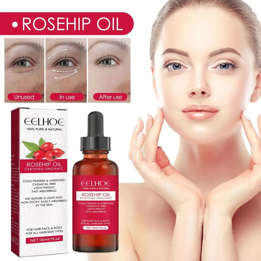 

30ml Organic Rosehip Seed Oil For Face Pure Cold Pressed Facial Oil Natural Moisturizing Skin Care Serum For Scars Stretch R8N1