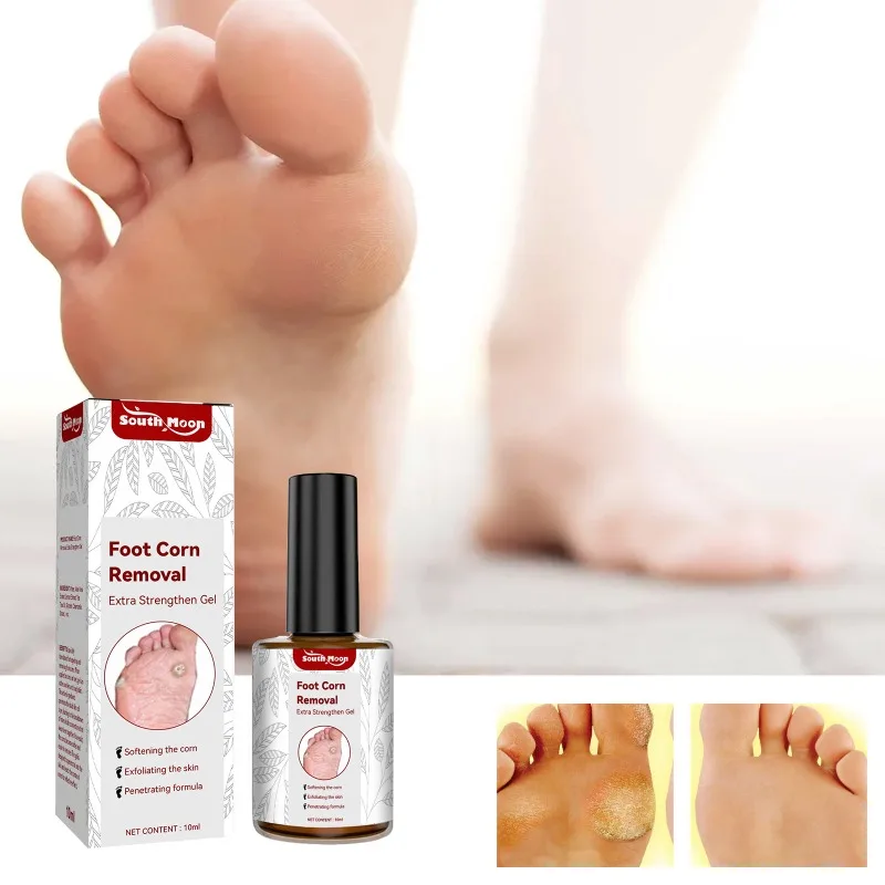 

10Ml Remove Foot Corn Care exfoliating Gel Anti Infection warts calluses removal repair Clean Fungal Treatment Cream Feet Care