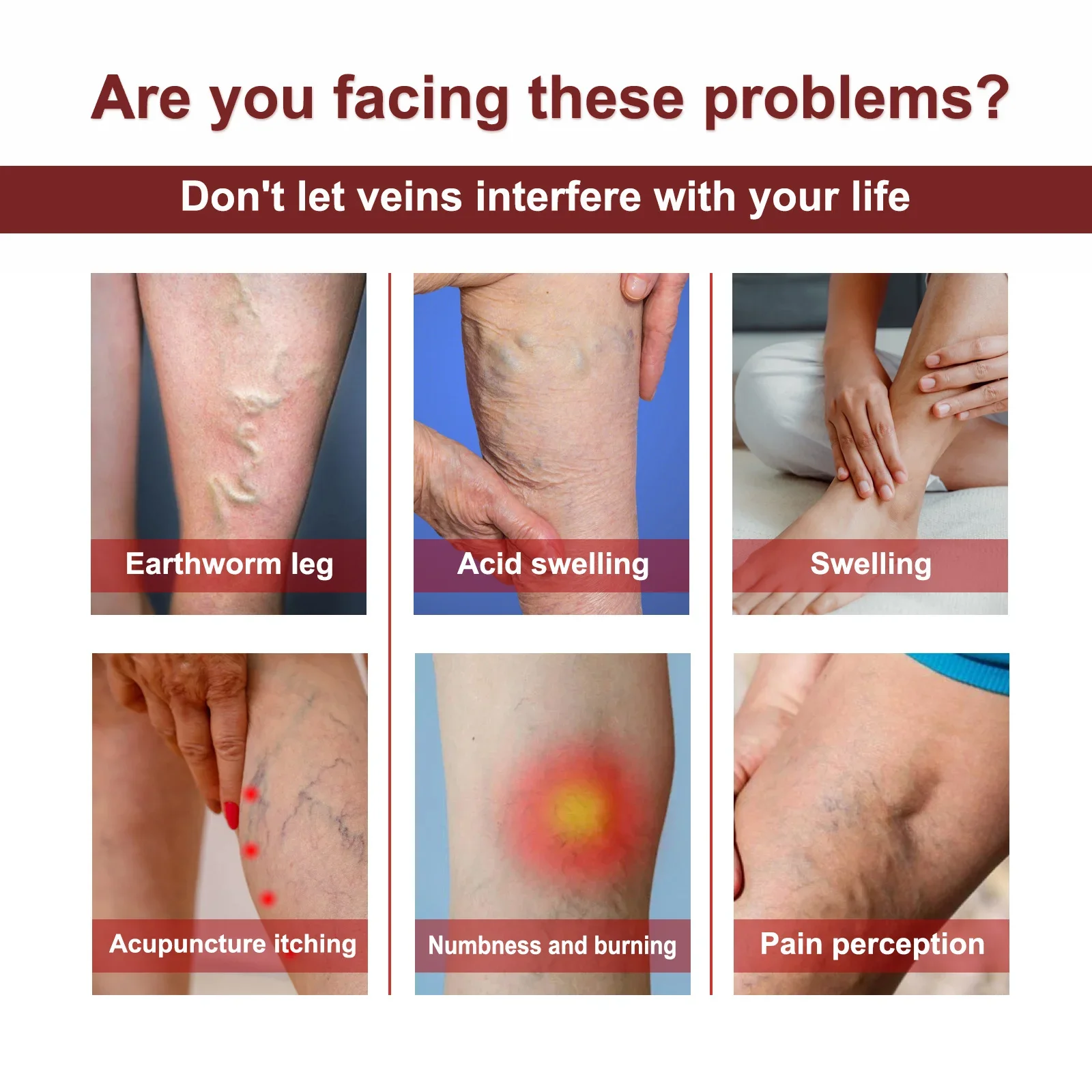 Мазь от варикозного расширения вен премиум-класса