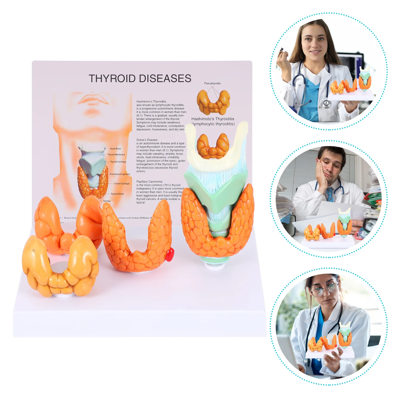 

1 Set Thyroid Model High Grade Premium Sturdy Durable Thyroid Model Mold Classroom