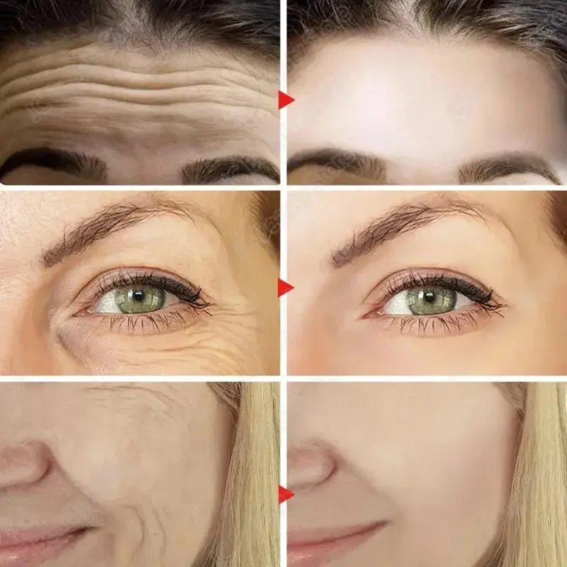 Набор для удаления морщин с ретинолом мгновенный укрепляющий лифтинг