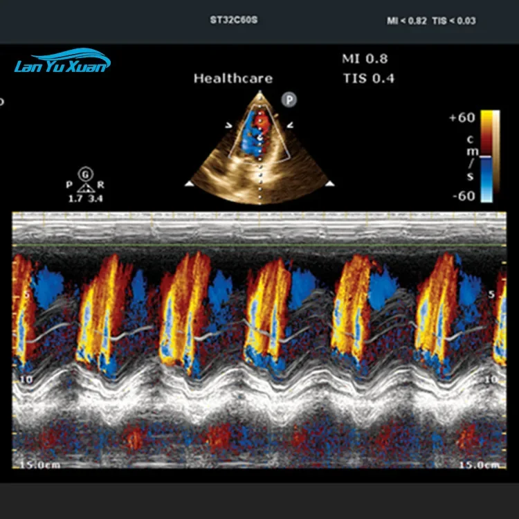 Рисунок 5 - Портативный цифровой цветной допплер