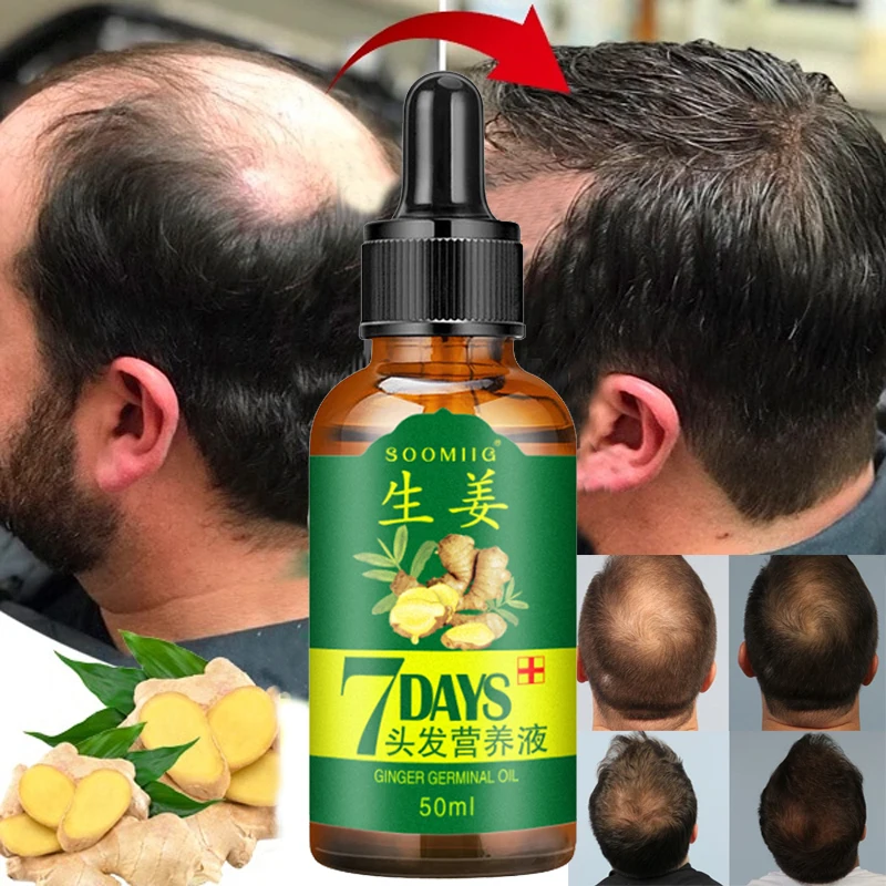 

Эссенция для роста волос в течение 7 дней, натуральное эфирное масло против выпадения волос, эффективный быстрой рост Уход за волосами и кож...