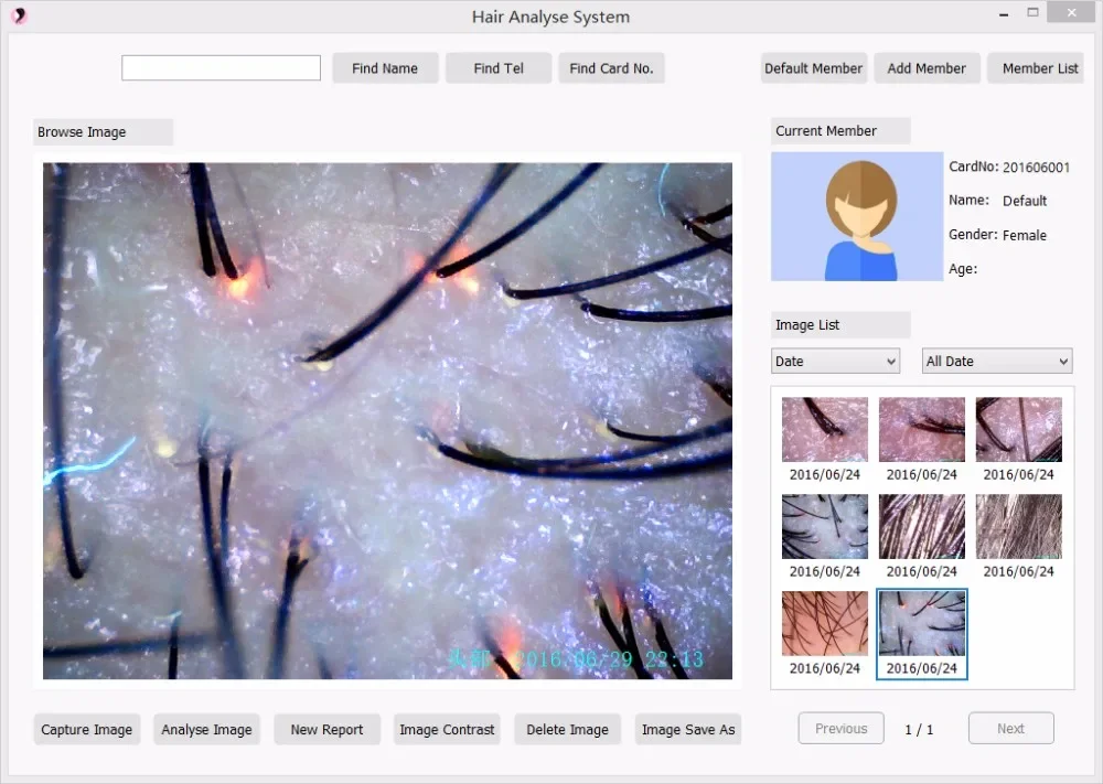 Анализатор диагностики иррископа кожи волос с анализами + ириса все в 1 машине