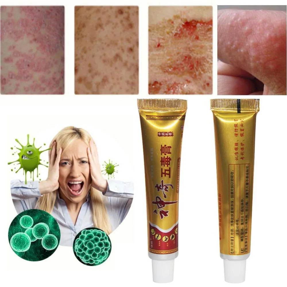 

Psoriasis Ointment Dermatitis Eczematoid Eczema Ointment Skin Treatment Cream Skin external ointment five poisonous grass cream