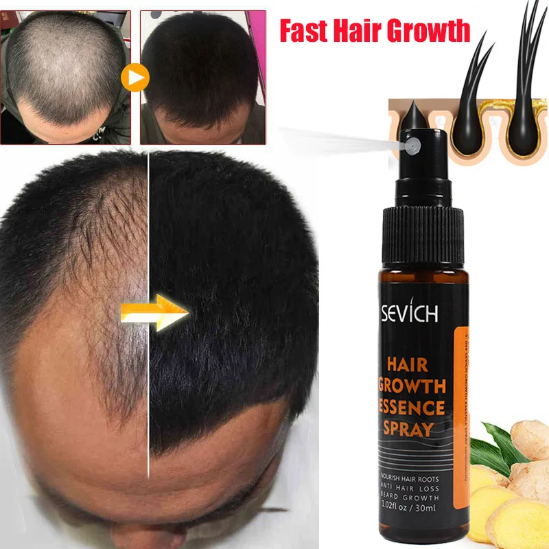 

Ginger Hair Growth Products Effective Anti Hair Loss Fast Growing Thickening Hair Essential Oil Spray Beauty Health Men Women