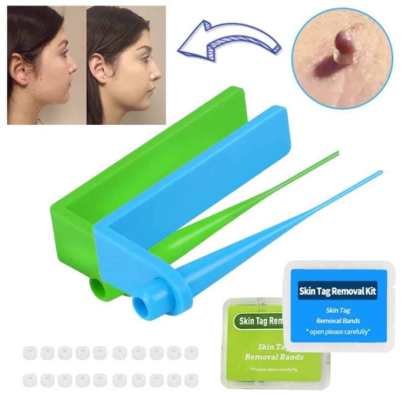 

Skin Tag Removal Kit Papilloma Removal Skin Tag Removal Device with Band Rubber Rings Tag Removal Kit Acne Needle Mole Tools