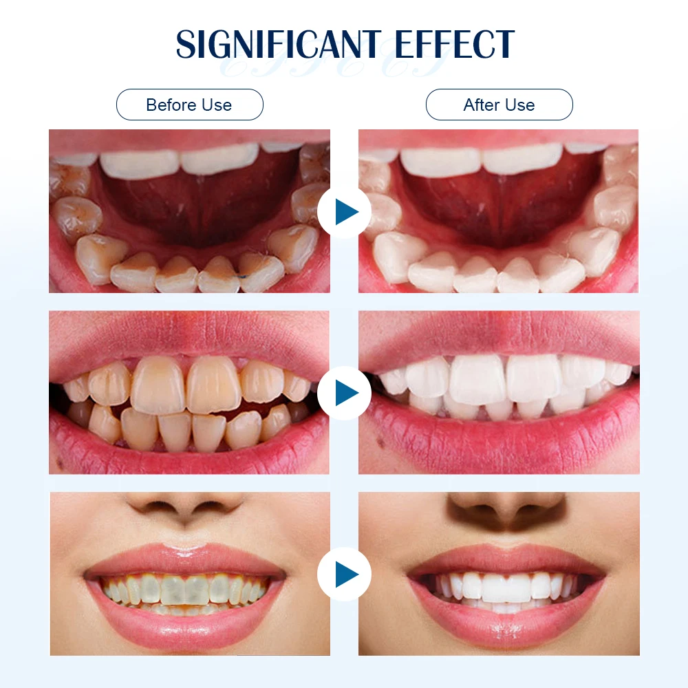 Электрический ультразвуковой ороситель для полости рта |
