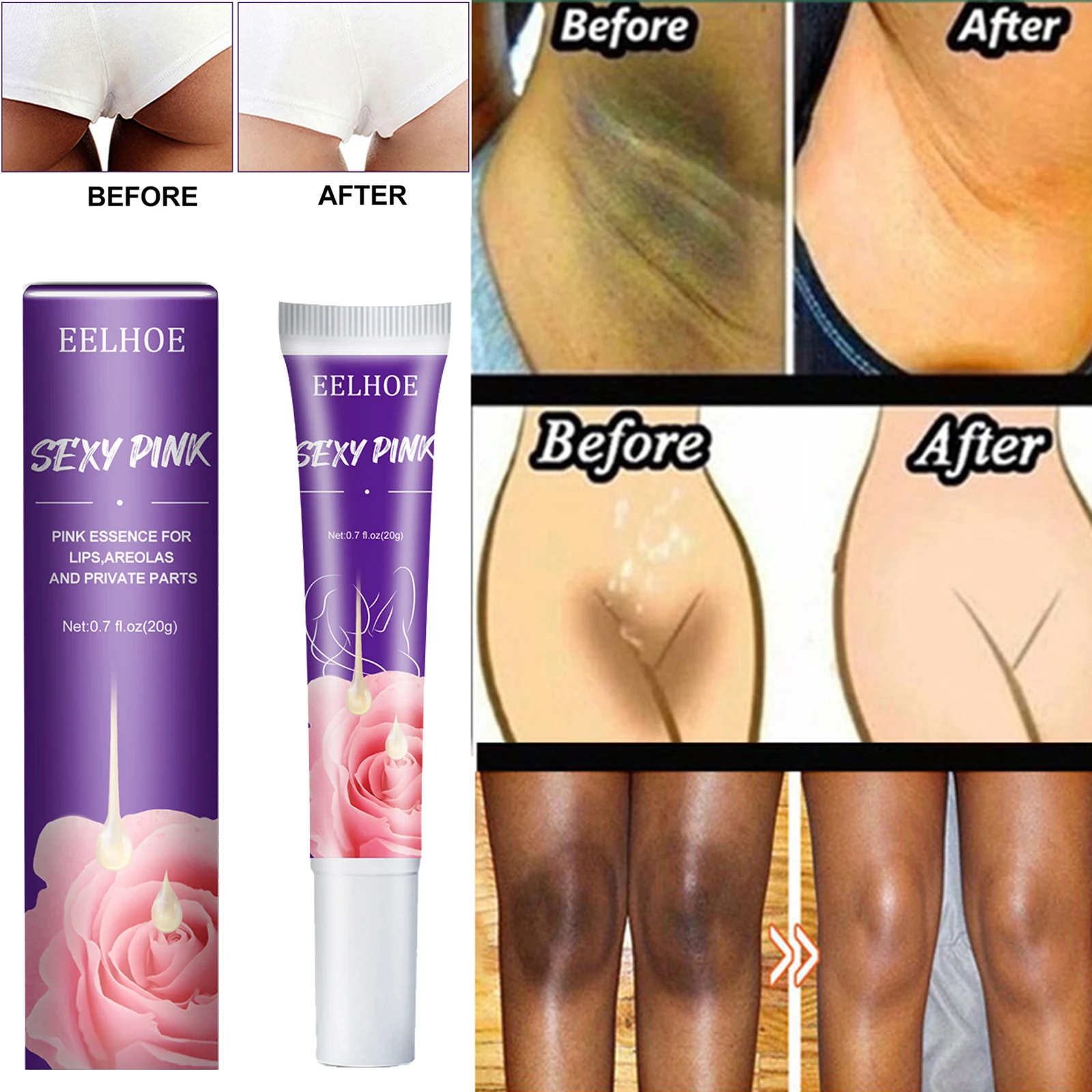 

Private Part Whitening Essence Lips Areolas Cream Underarm Bleach Serum Whiten Butt Knee Brighten Intimate Parts Remove Melanin