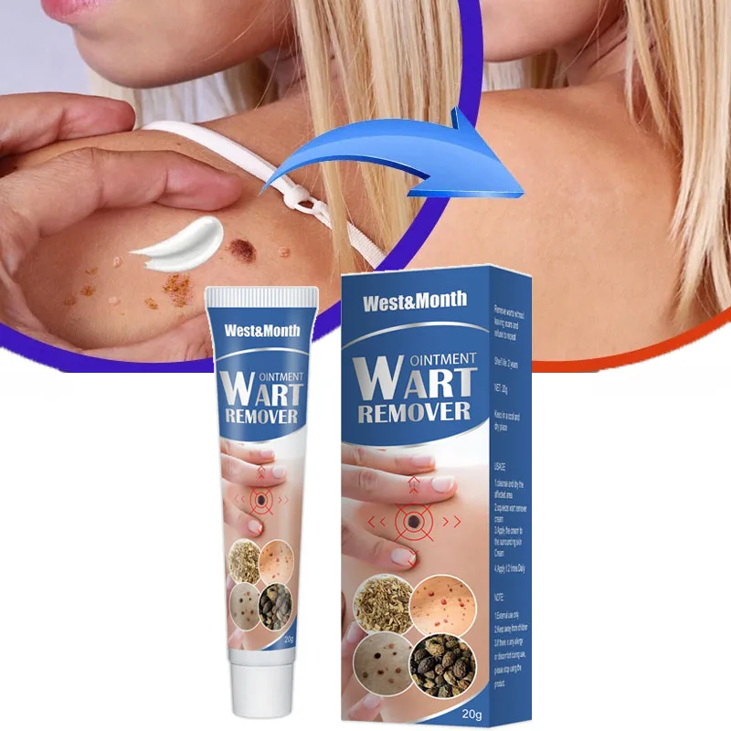 

Skin Tag Remover Cream Painles Fast Dark Spot Mole Warts Removal Serum Freckle Face Flat Wart Tag Repair Treatment Essential Oil