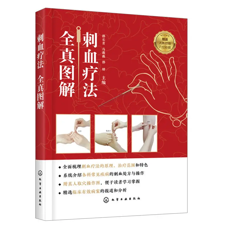 Complete Picture of Blood Pricking Therapy, Book of Blood Pricking Therapy, Complete Book of Blood Pricking Therapy In China