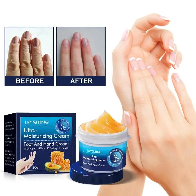 

Hands And Foot Moisturizer Double Nourish Hand Cream Long-lasting Water Supplement Foot Cream For Skin Peeling And Hand Lotion