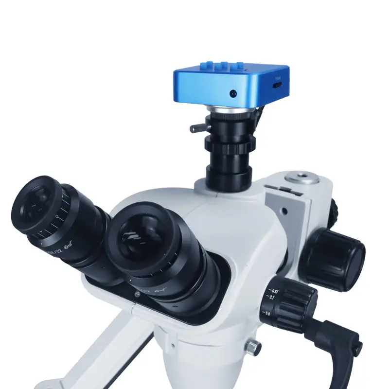 Рисунок 4 - Стоматологический микроскоп с камерой