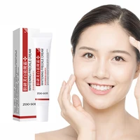 whitening face cream repair freckle cream moisturizing skin lightening for dark spots remover freckle cream face skin care