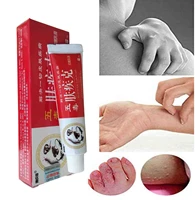rash treatment psoriasis ointment natural chinese herbal eczema creams dermatitis pruritus anti itch external use only fjk