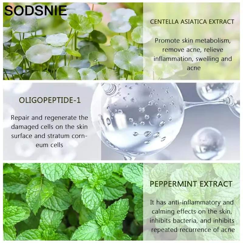 Фото Увлажняющая сыворотка Centella Asiatica для лица, сужение пор, нежное восстановление эссенции от прыщей, улучшение грубого, контроль жирности кожи 30 мл №4