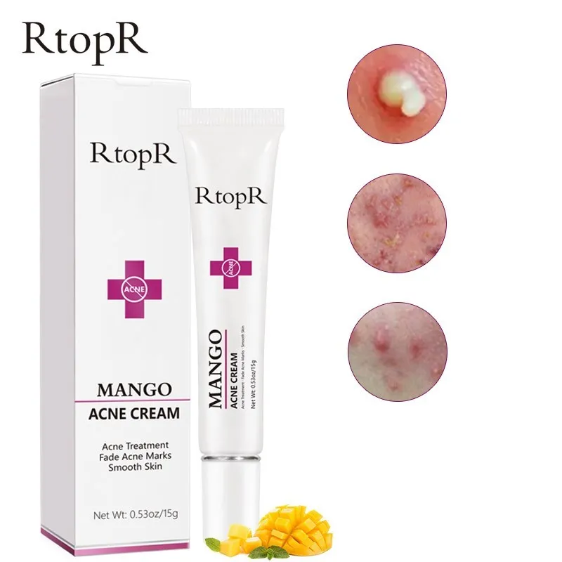 RtopR для лечения прыщей крем удаления черных точек ремонт гель масло Управление