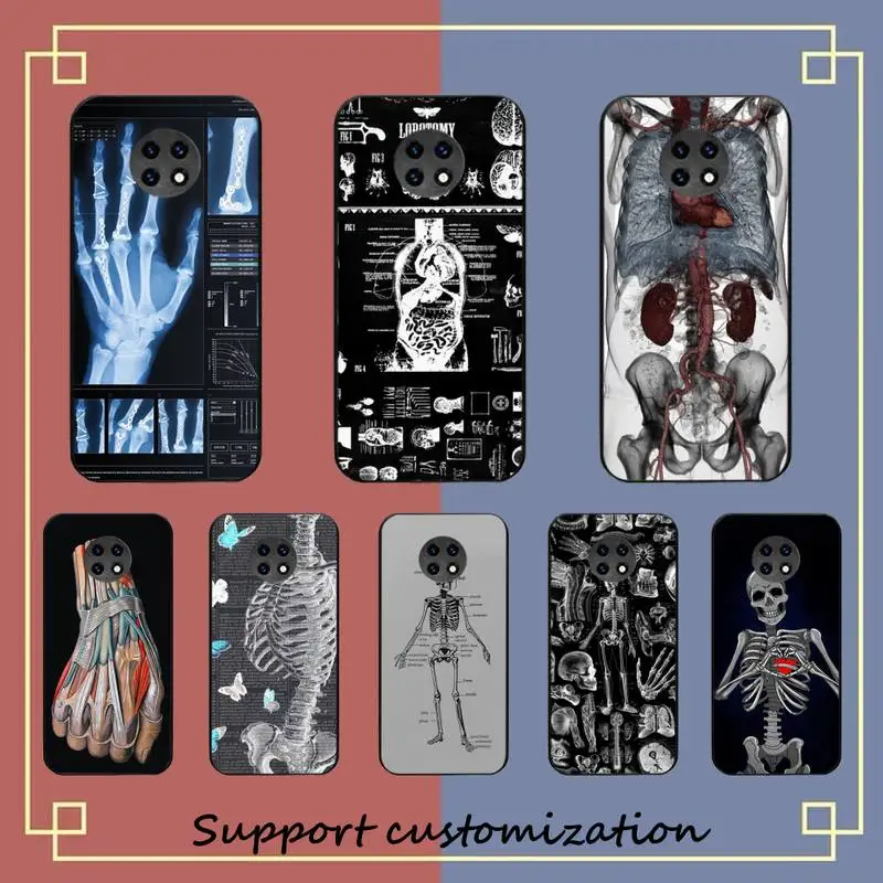 Radiological human organs Skeleton skull art Phone Case for Redmi Note 8 7 9 4 6 pro max T X 5A 3 10 lite pro