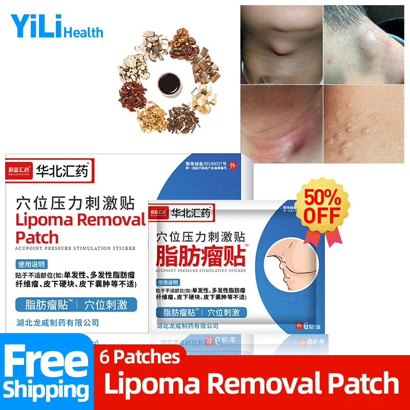 

Lipoma Remover Medical Patch Fat Mass Plaster Apply To Subcutaneous Lumps Treatment Cellulite Fibroma Medicine CFDA Approve