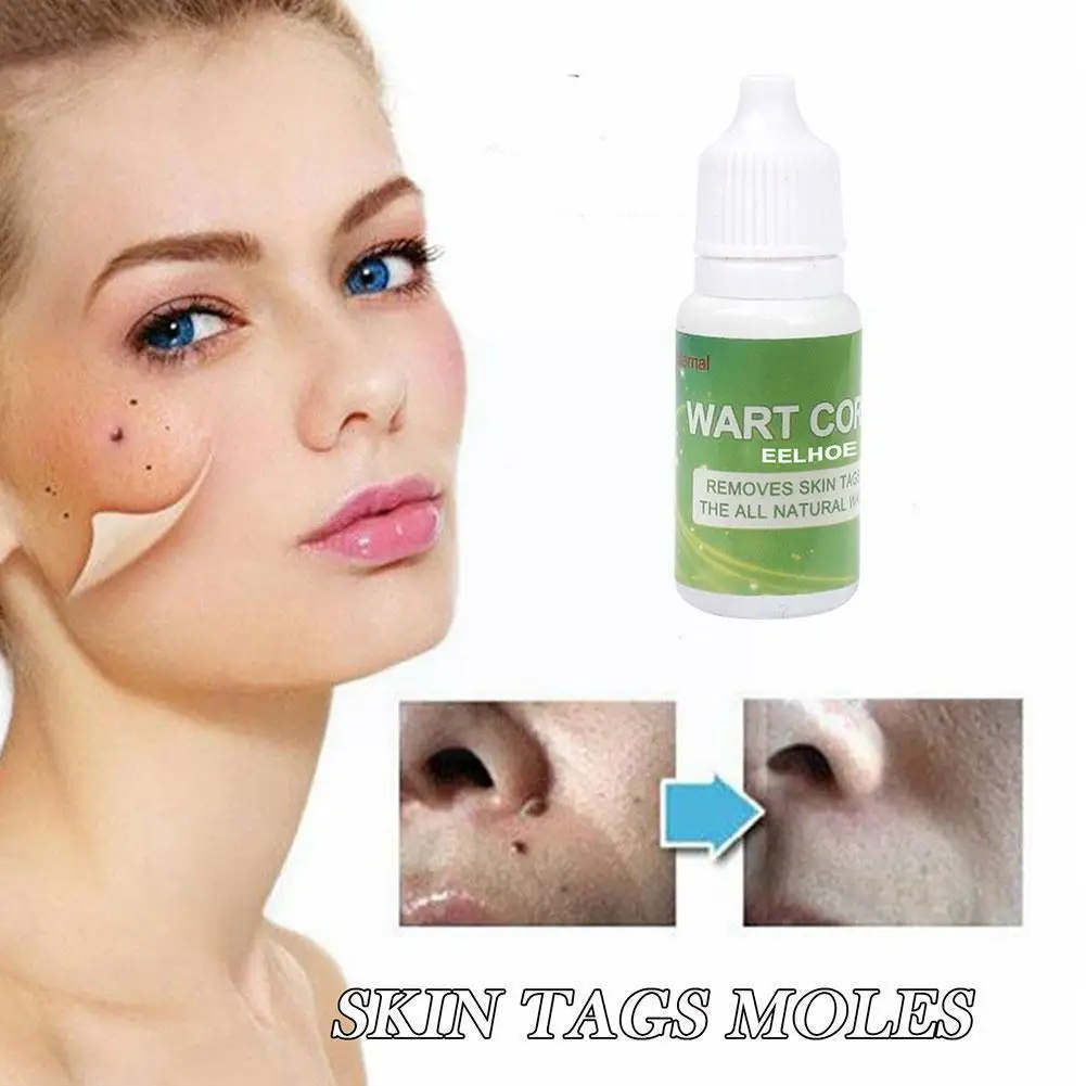 

Skin Mole Remover Fast Removal Genital Wart Acne Spot Rapidly Tag Against Treatment Fast Or Removes Remover Skin Mole Moles C4c5