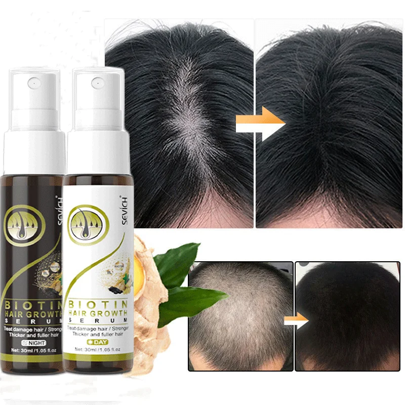 Day Night Ginger Hair Growth Spray Serum Anti Hair Loss Treatment Product Prevent Thinning Dry Frizzy Repair Beauty Hair Care