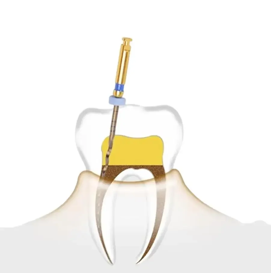 AG 6 шт. стоматологические эндодонтические файлы золотой эндодонтический