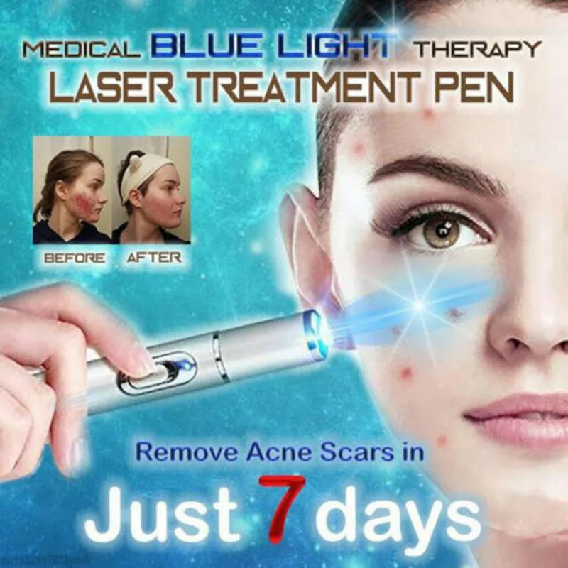 Acne Laser Treatment Pen Pimple Scar Removal Device Dark Spots Corn Tags Remover Blue Light Therapy Pen Whitening Skin Care Tool