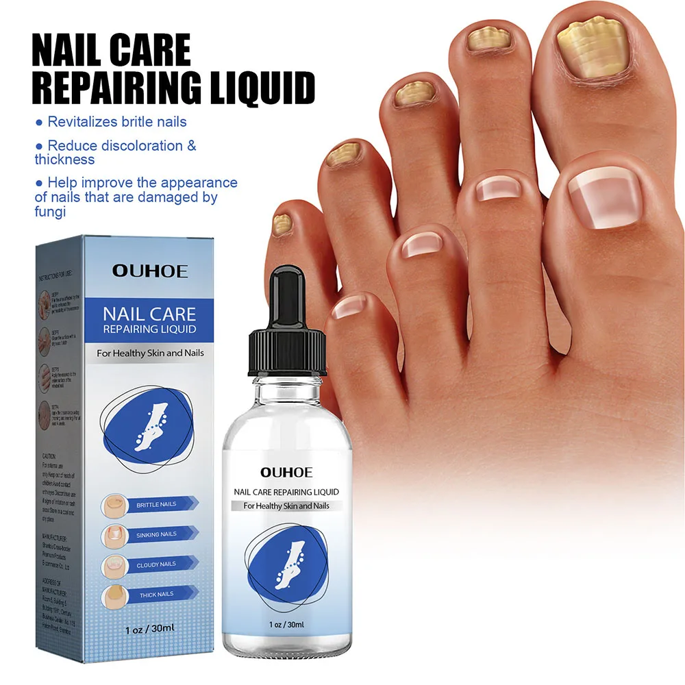 

Многофункциональные экстракты для восстановления ногтей, раствор для онихомикоза, принадлежности для ухода за ногтями, утолщение, очистка ногтей, осветляющая эссенция