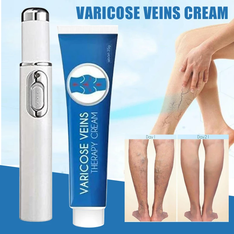 

Крем-ручка для лечения варикозного расширения вен с сисветильник Том, 1 шт., 20 г