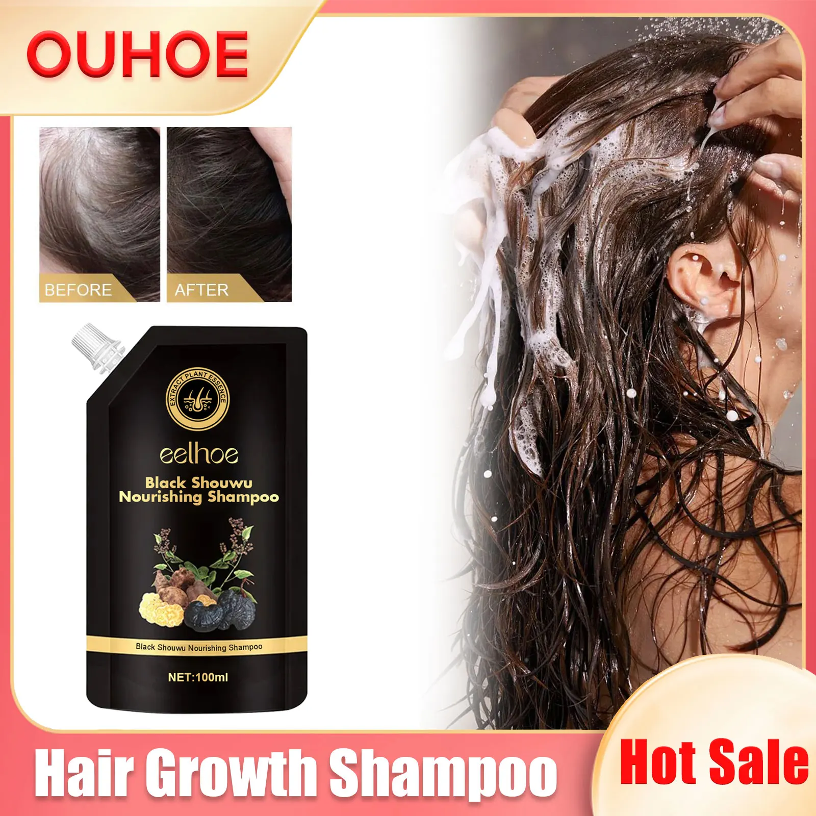

Anti Hair Loss Shampoo Scalp Treatment Oil Control Nourishing Reduce Itching Deep Cleaning Dandruff Thicken Hair Growth Product