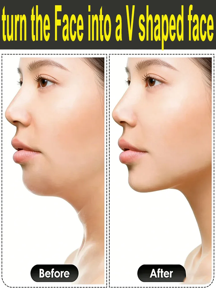 Фото Подтяните линию челюсти и превратите лицо в V-образную форму. №1