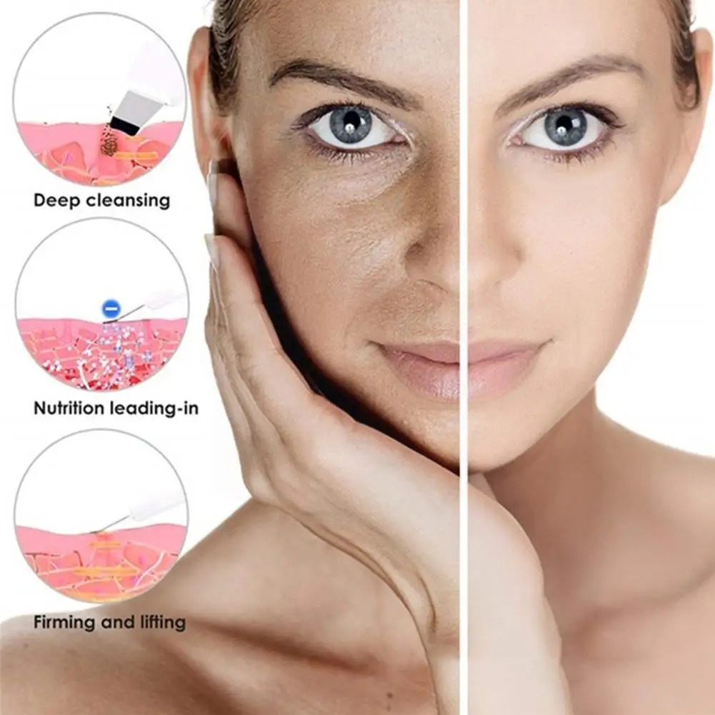 

Ultrasonic Skin Scrubber Spatula Deap Cleaning Skin EMS Cleaner Face Peeling RF Skin Spray Device Beauty LED Care I6W2