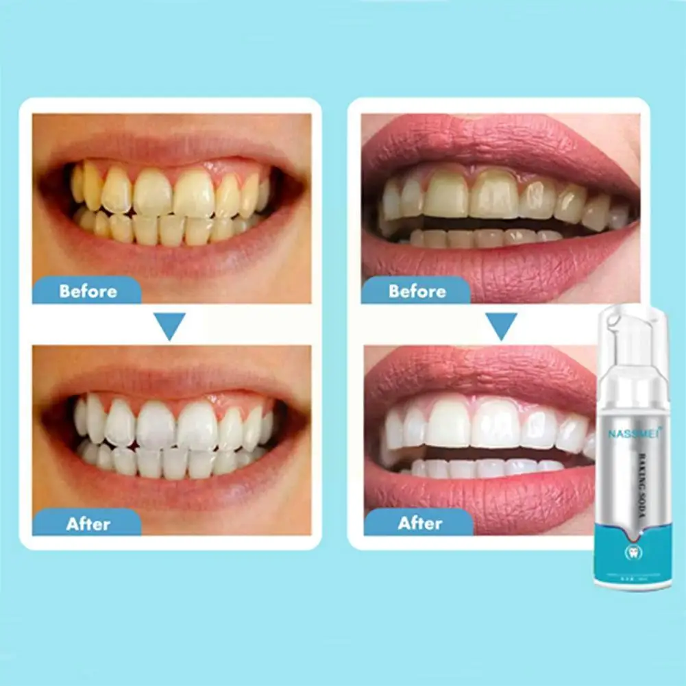 

60ml Tooth Whitening Cleaning Mousse Remove Plaque Dental Care Breath Teeth Stains Bright Odor Toothpaste Tool K8e1