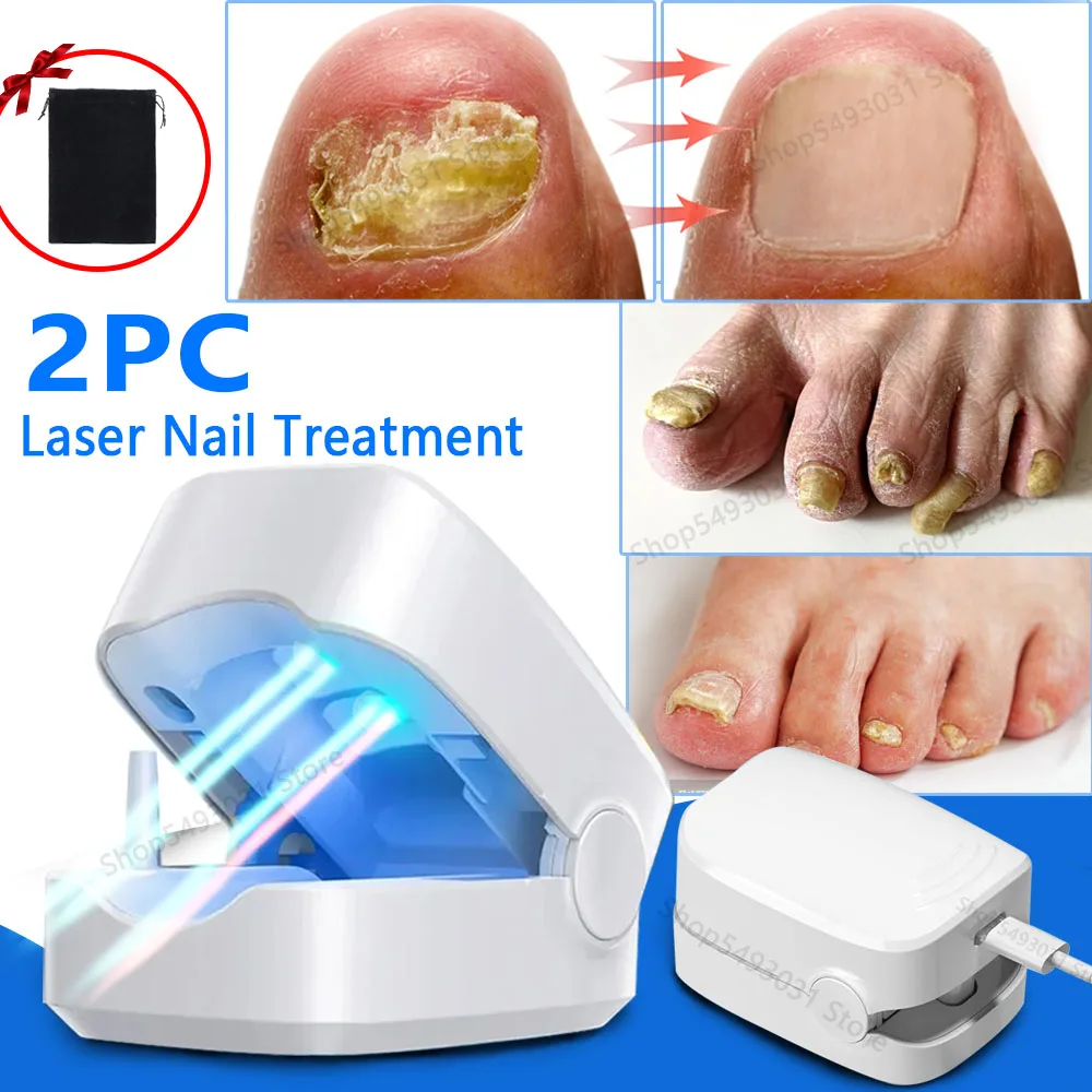 Электрическое устройство для лечения грибка ногтей противогрибковое средство