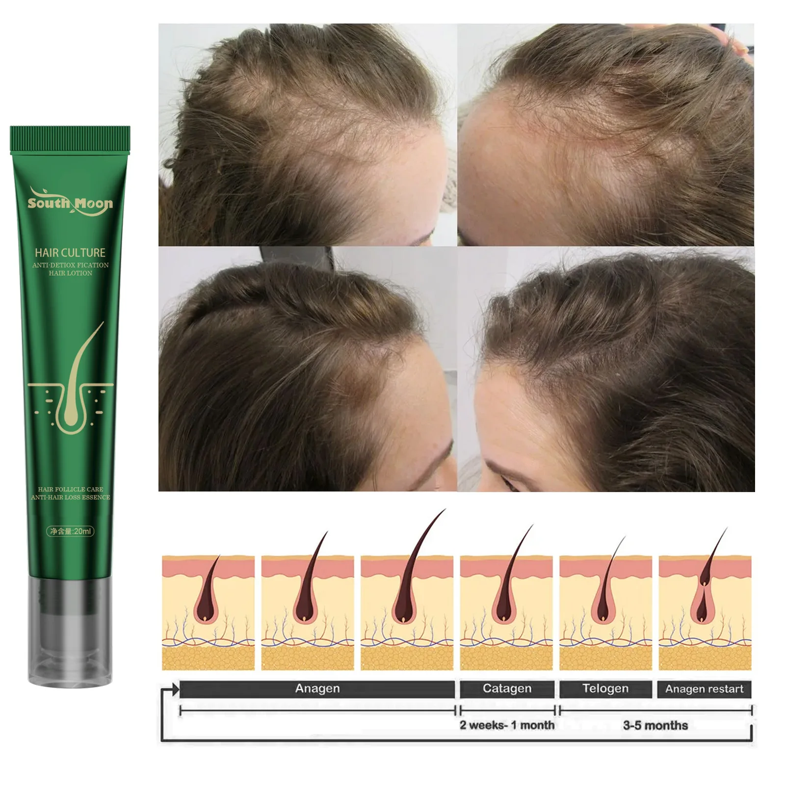 

Hair Growth Essence Scalp Treatment Regeneration Serum Anti Hair Loss Prevent Baldness Fast Effective Hair Restoration Hair Care